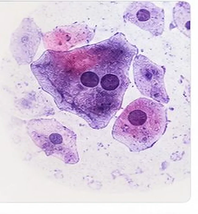 Illustrative microscopic cellular image; chlamydia often has no visible skin lesions — AI-generated medical illustration, not an actual patient photograph