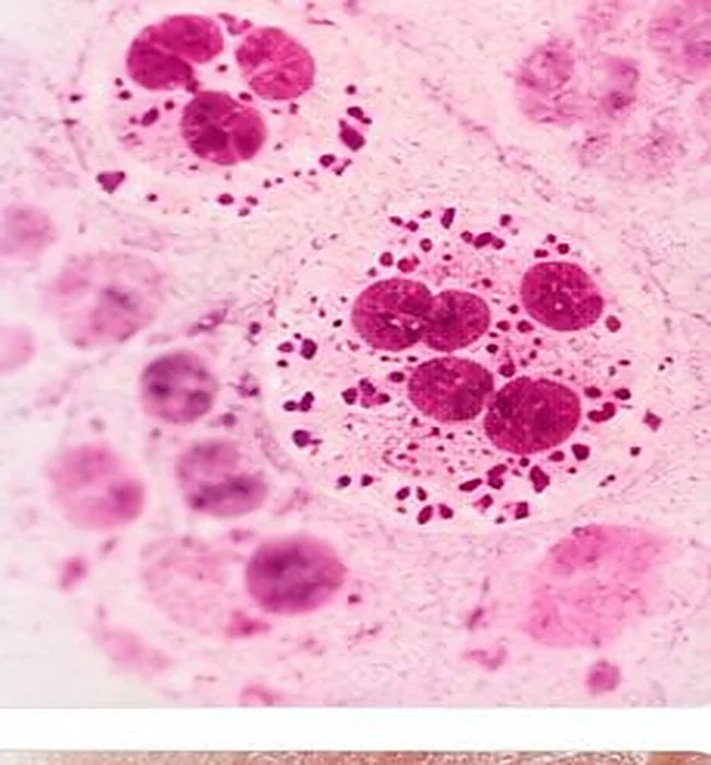 Stylised microscopic illustration for gonorrhoea; laboratory testing is needed — AI-generated medical illustration, not an actual patient photograph