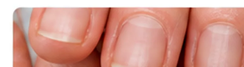 Close-up of fingernails